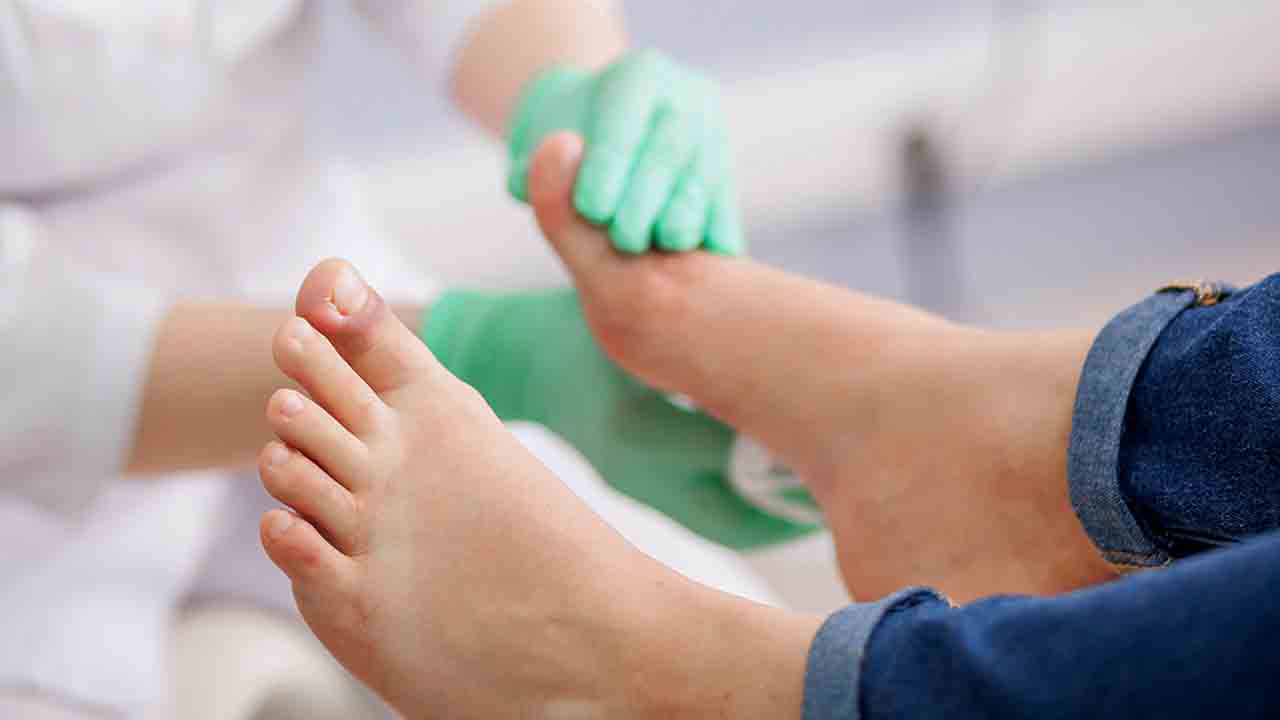 Şeker Hastası’nın Ayağını kurtarmak -1
