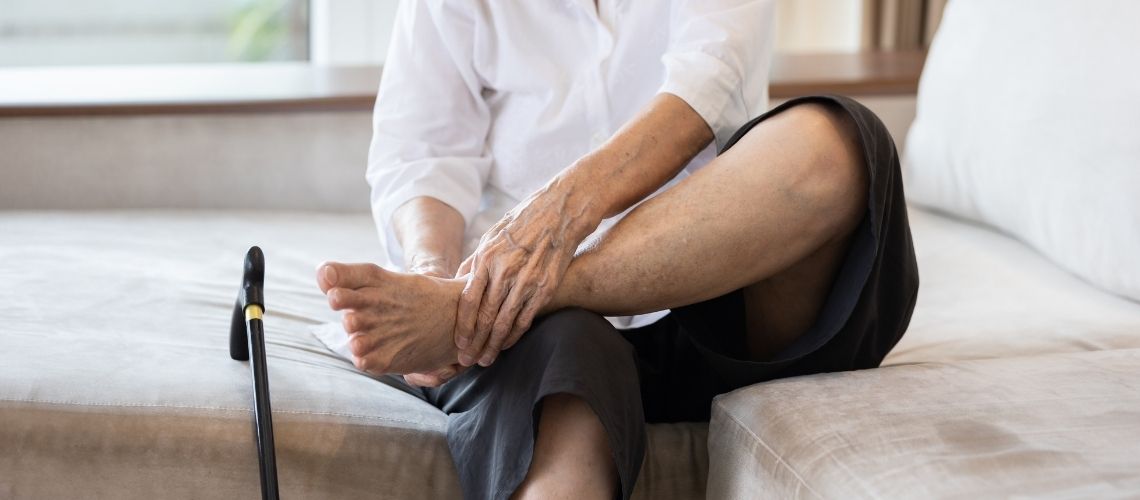 Buerger Hastaligi Tedavisi